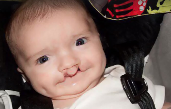 different-eyes-colors-cat-moon-boy-madden-friendship-20