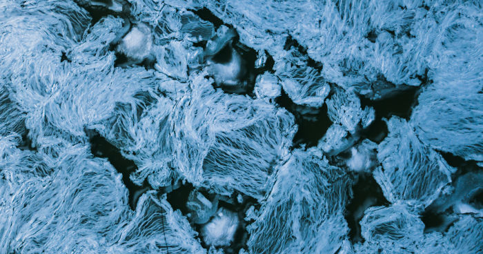 Drone Or Microscope?