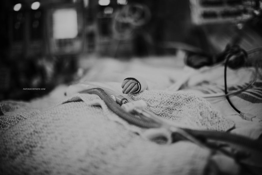 My Son Had Three Open Heart Surgeries Before The Age Of 5, And Here's How Our Journey Went My Son Had Three Open Heart Surgeries Before The Age Of 5, And Here's How Our Journey Went