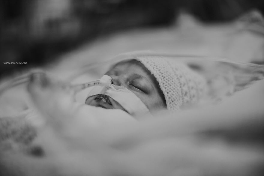 My Son Had Three Open Heart Surgeries Before The Age Of 5, And Here's How Our Journey Went