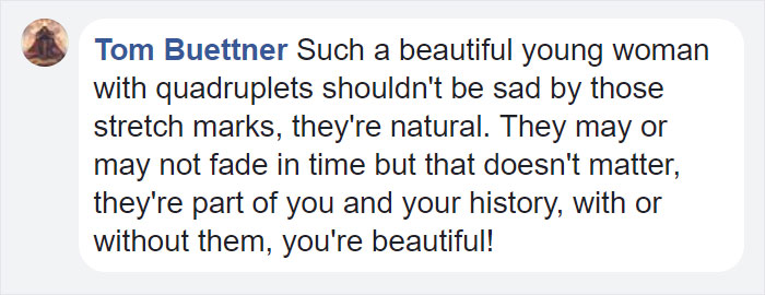 Trolls Tell 23-Year-Old Mom Her ‘Disgusting’ Stretch Marks Make Them Want To Vomit, But She Had The Best Response Trolls Tell 23-Year-Old Mom Her ‘Disgusting’ Stretch Marks Make Them Want To Vomit, But She Had The Best Response