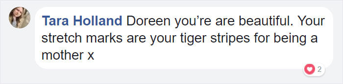 Trolls Tell 23-Year-Old Mom Her ‘Disgusting’ Stretch Marks Make Them Want To Vomit, But She Had The Best Response