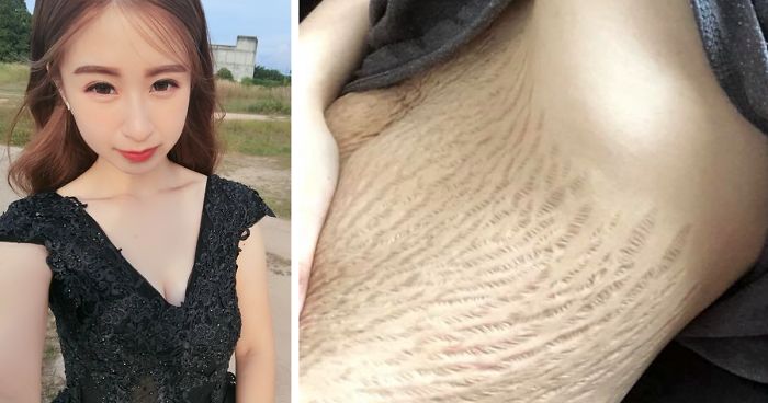 Bullies Told This Mom Of Quadruplets Her Belly Makes Them Want To Vomit, And Here's How She RespondedBullies Told This Mom Of Quadruplets Her Belly Makes Them Want To Vomit, And Here's How She Responded