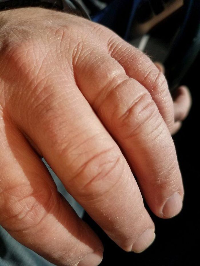 The Mark Left Over After My Father Took Off His Wedding Ring For The First Time In 20 Years