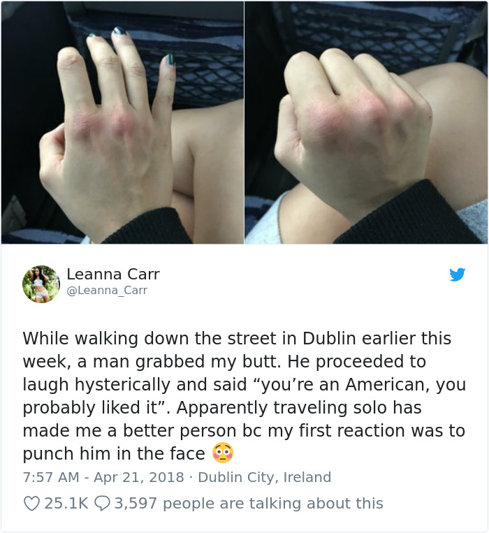 Woman Is Sexually Assaulted On Street, But Attacker Doesn't Realize What Is Hiding Beneath Her Innocent Look Woman Is Sexually Assaulted On Street, But Attacker Doesn't Realize What Is Hiding Beneath Her Innocent Look