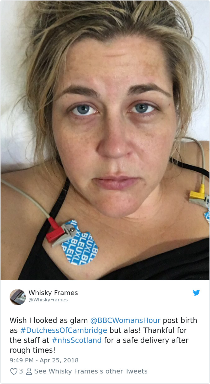 Women Are Posting Their Post-Birth Pics After Kate Middleton's Flawless Photos To Show How Different It Was For Them Women Are Posting Their Post-Birth Pics After Kate Middleton's Flawless Photos To Show How Different It Was For Them