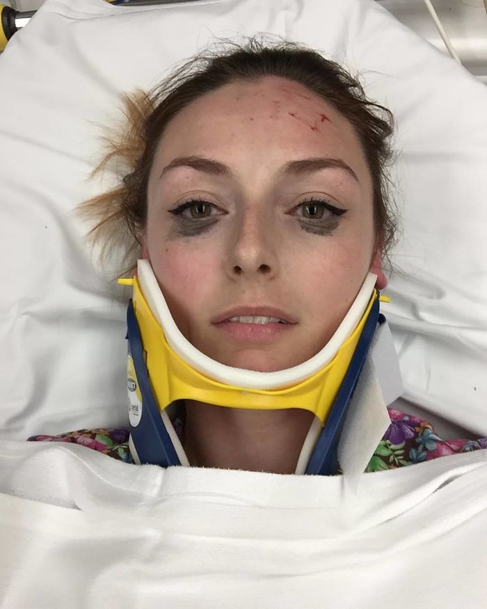 Woman in neck brace with intact eyeliner after car accident. Woman in neck brace with intact eyeliner after car accident.