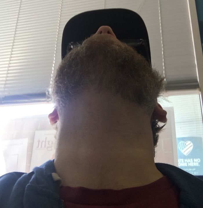 Beard Neck