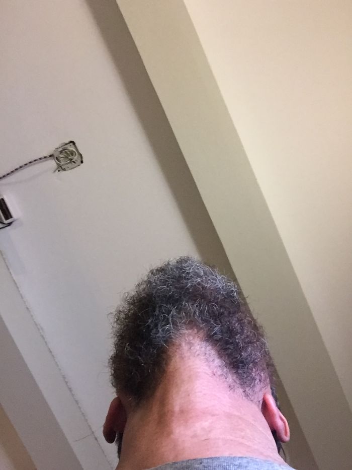 Turns Out I Am Really A Black Guy With A Greying Afro