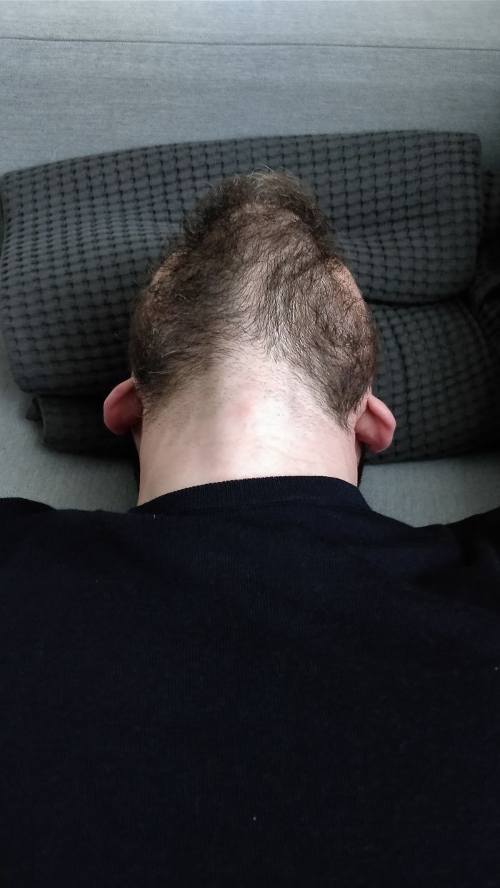 I Was Surprised I Look This Way