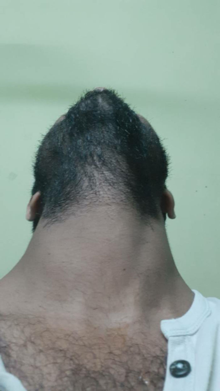 Im A Hairy Mountain Biatchhhhh