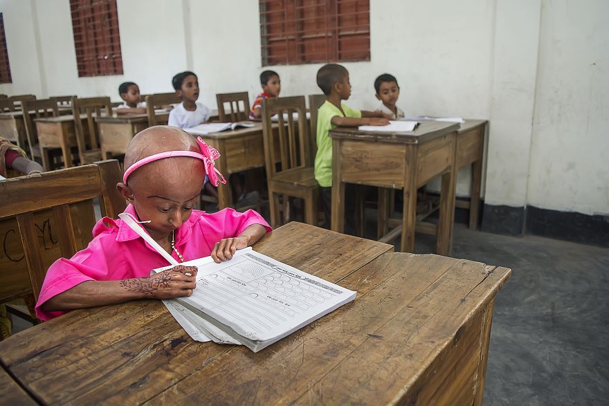Doctors Gave This Girl 3 More Years To Live, And She's Becoming An Example On How To Enjoy Life Doctors Gave This Girl 3 More Years To Live, And She's Becoming An Example On How To Enjoy Life