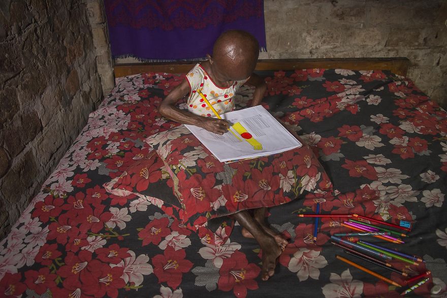 Doctors Gave This Girl 3 More Years To Live, And She's Becoming An Example On How To Enjoy Life Doctors Gave This Girl 3 More Years To Live, And She's Becoming An Example On How To Enjoy Life