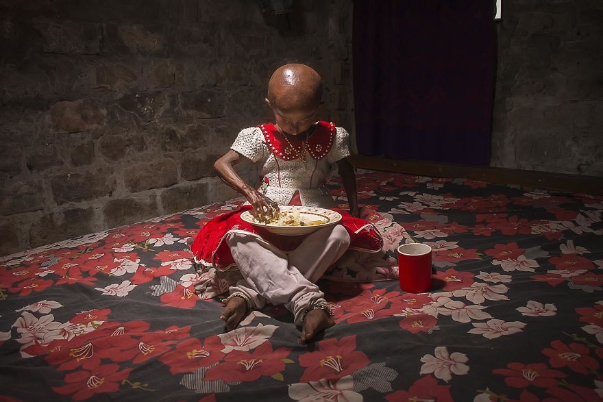 Doctors Gave This Girl 3 More Years To Live, And She's Becoming An Example On How To Enjoy Life Doctors Gave This Girl 3 More Years To Live, And She's Becoming An Example On How To Enjoy Life