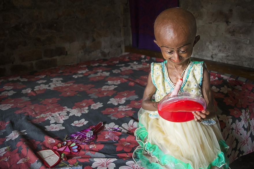 Doctors Gave This Girl 3 More Years To Live, And She's Becoming An Example On How To Enjoy Life Doctors Gave This Girl 3 More Years To Live, And She's Becoming An Example On How To Enjoy Life