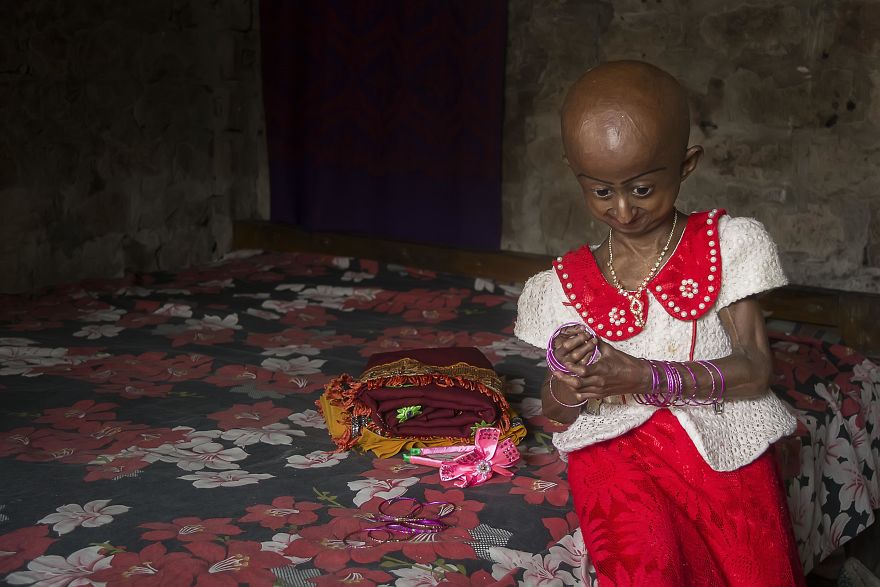 Doctors Gave This Girl 3 More Years To Live, And She's Becoming An Example On How To Enjoy Life Doctors Gave This Girl 3 More Years To Live, And She's Becoming An Example On How To Enjoy Life