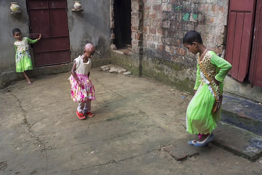 Doctors Gave This Girl 3 More Years To Live, And She's Becoming An Example On How To Enjoy Life Doctors Gave This Girl 3 More Years To Live, And She's Becoming An Example On How To Enjoy Life