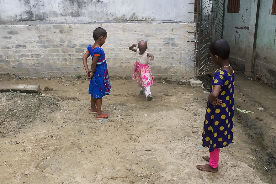 Doctors Gave This Girl 3 More Years To Live, And She's Becoming An Example On How To Enjoy Life Doctors Gave This Girl 3 More Years To Live, And She's Becoming An Example On How To Enjoy Life