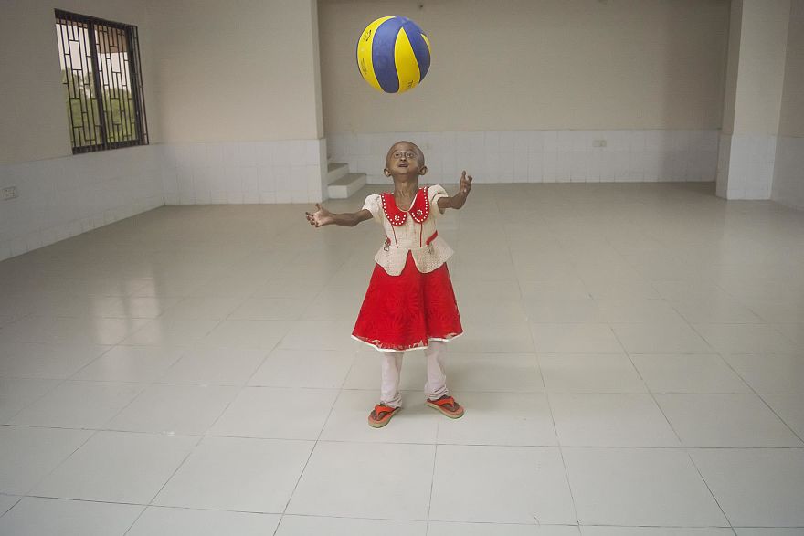 Doctors Gave This Girl 3 More Years To Live, And She's Becoming An Example On How To Enjoy Life Doctors Gave This Girl 3 More Years To Live, And She's Becoming An Example On How To Enjoy Life