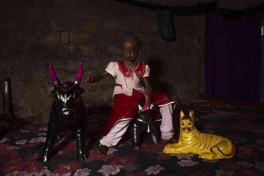 Doctors Gave This Girl 3 More Years To Live, And She's Becoming An Example On How To Enjoy Life Doctors Gave This Girl 3 More Years To Live, And She's Becoming An Example On How To Enjoy Life