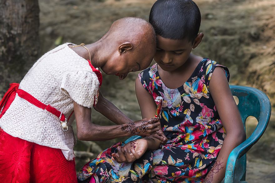 Doctors Gave This Girl 3 More Years To Live, And She's Becoming An Example On How To Enjoy Life Doctors Gave This Girl 3 More Years To Live, And She's Becoming An Example On How To Enjoy Life