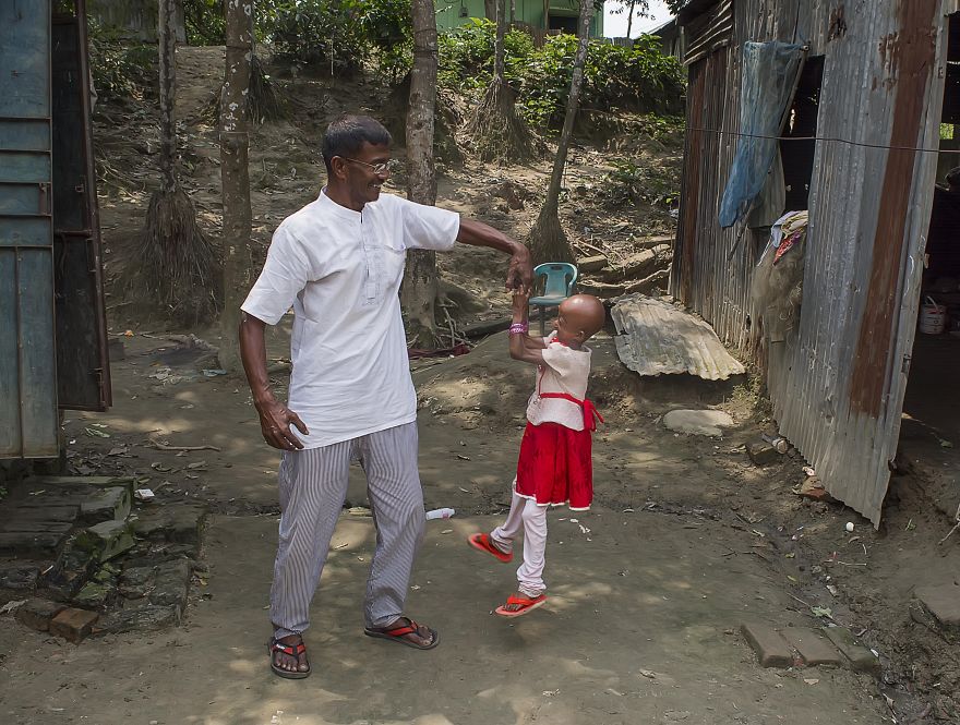 Doctors Gave This Girl 3 More Years To Live, And She's Becoming An Example On How To Enjoy Life Doctors Gave This Girl 3 More Years To Live, And She's Becoming An Example On How To Enjoy Life