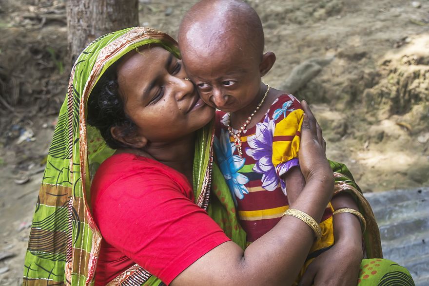 Doctors Gave This Girl 3 More Years To Live, And She's Becoming An Example On How To Enjoy Life Doctors Gave This Girl 3 More Years To Live, And She's Becoming An Example On How To Enjoy Life