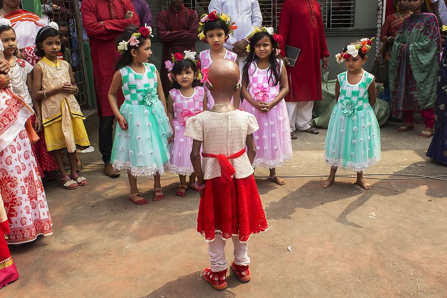 Doctors Gave This Girl 3 More Years To Live, And She's Becoming An Example On How To Enjoy Life Doctors Gave This Girl 3 More Years To Live, And She's Becoming An Example On How To Enjoy Life