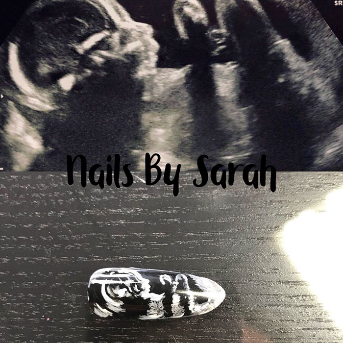 Women Are Getting Ultrasound Scans Painted On Their Nails And People Have Mixed Feelings About It