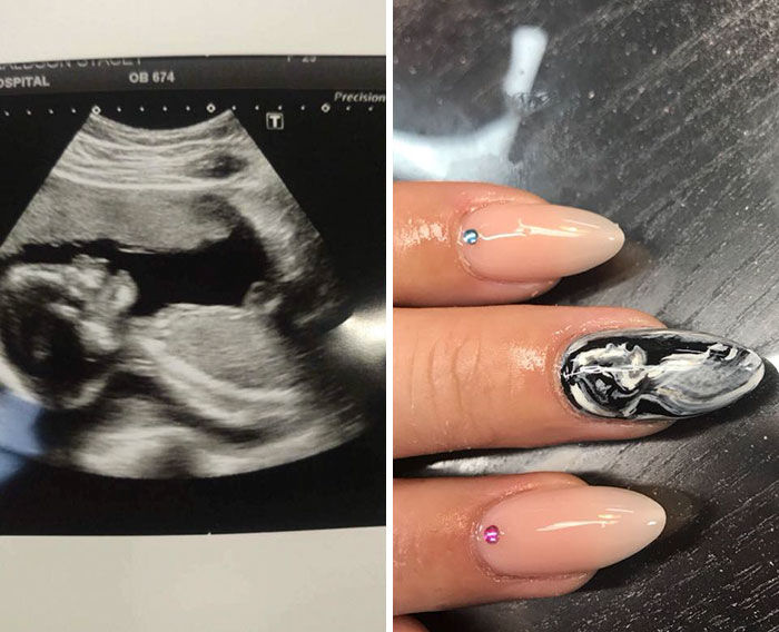 Women Are Getting Ultrasound Scans Painted On Their Nails And People Have Mixed Feelings About It Women Are Getting Ultrasound Scans Painted On Their Nails And People Have Mixed Feelings About It