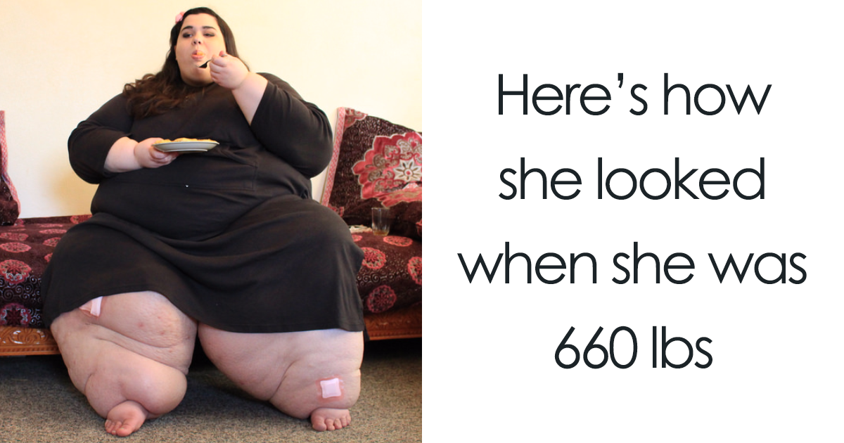 25 Unbelievable Before & After Transformation Pics From ‘My 600 Lb Life’