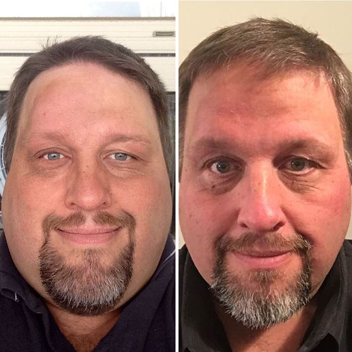 Obese Dad Finds Out He Needs 2 Seats On Evacuation Flight, Transforms His Body Beyond Recognition In 2 Years Obese Dad Finds Out He Needs 2 Seats On Evacuation Flight, Transforms His Body Beyond Recognition In 2 Years