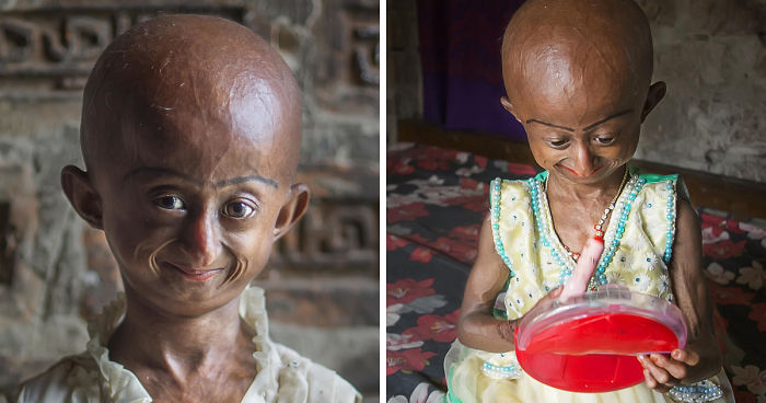 Doctors Gave This Girl 3 More Years To Live, And She's Becoming An Example On How To Enjoy LifeDoctors Gave This Girl 3 More Years To Live, And She's Becoming An Example On How To Enjoy Life