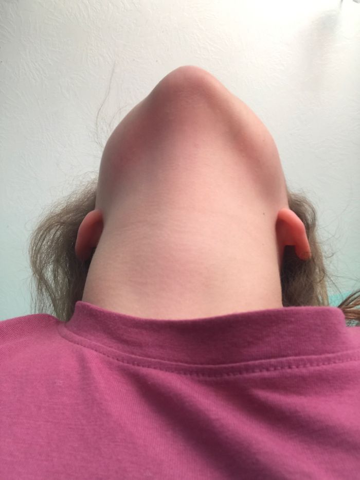 It’s Not Just Beards