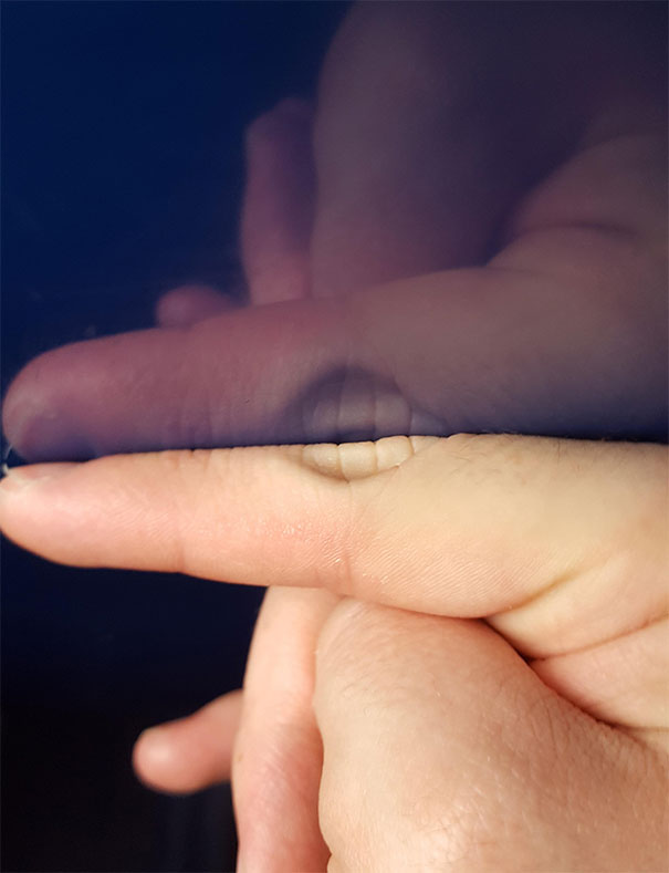 The Reflection Of My Finger Looks Like Teeth