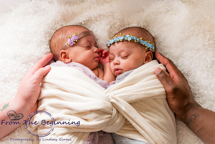 Woman Gives Birth To Another Set Of Rare Identical Twins Against 10-Million-To-One Odds Woman Gives Birth To Another Set Of Rare Identical Twins Against 10-Million-To-One Odds