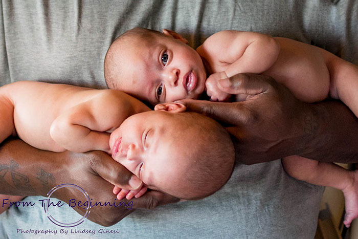 Woman Gives Birth To Another Set Of Rare Identical Twins Against 10-Million-To-One Odds Woman Gives Birth To Another Set Of Rare Identical Twins Against 10-Million-To-One Odds