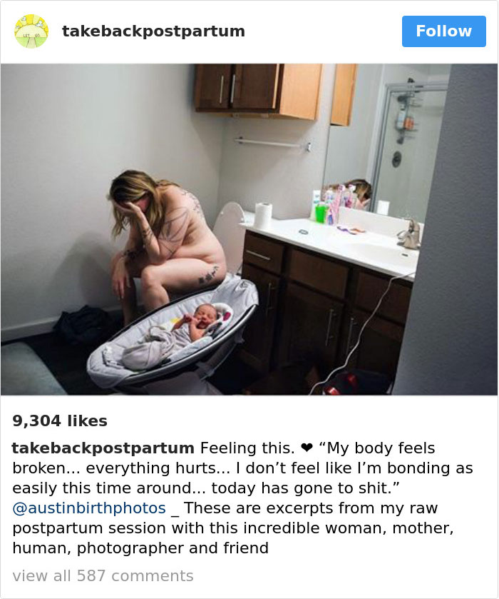 Postpartum Bodies