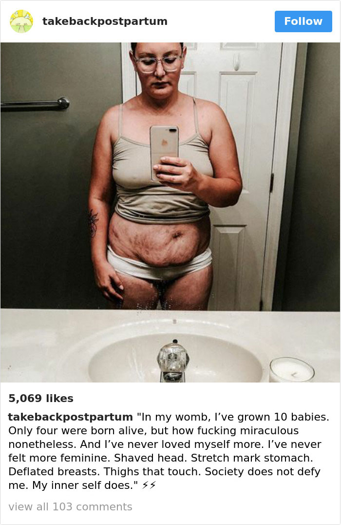 Postpartum Bodies