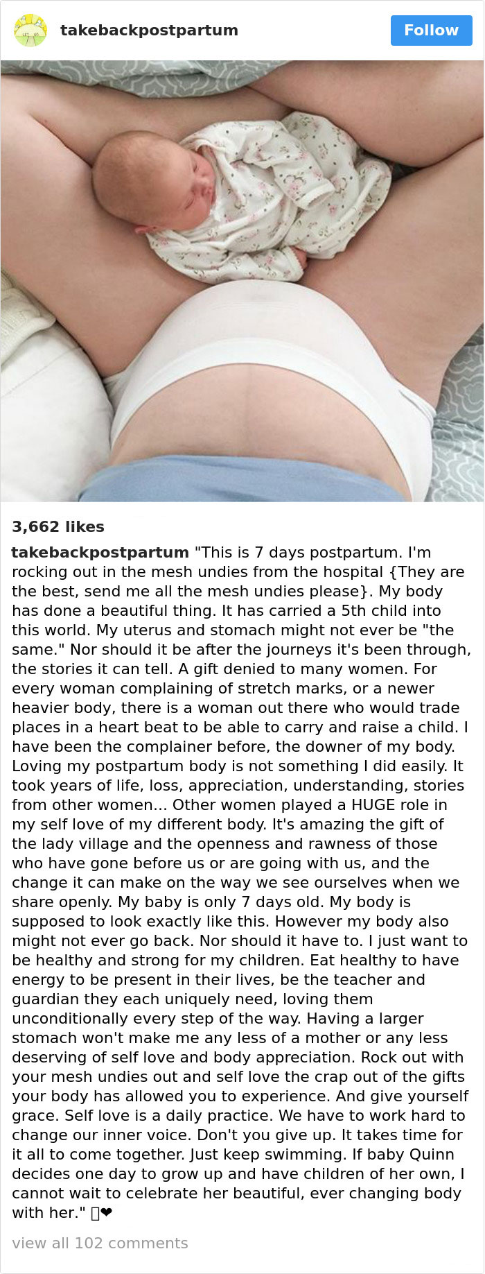 Postpartum Bodies