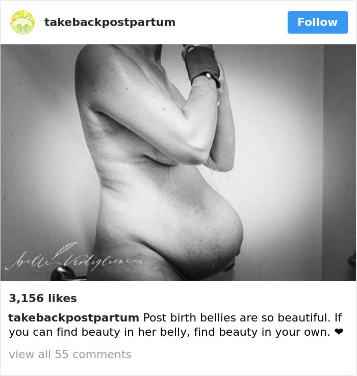 Postpartum Bodies