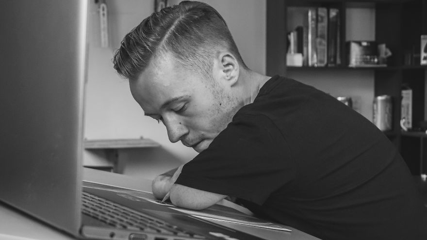 Despite Being Born Without Arms, I Still Managed To Fulfill My Dream Of Opening A Solo Exhibition In NYC