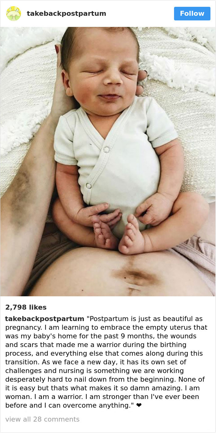 Postpartum Bodies