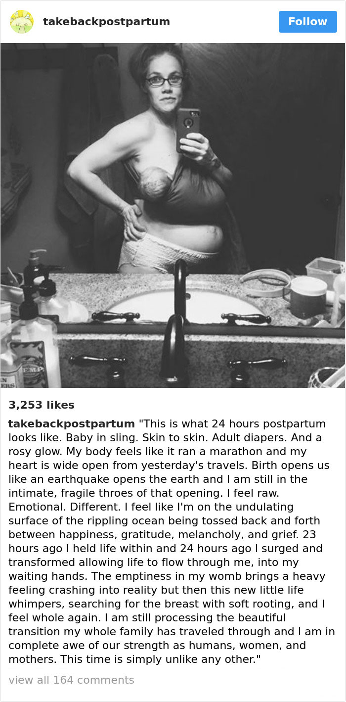 Postpartum Bodies