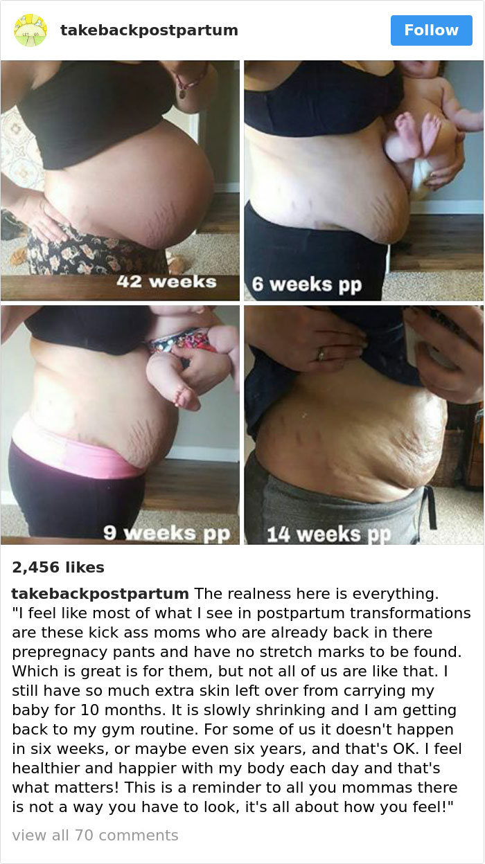 Postpartum Bodies