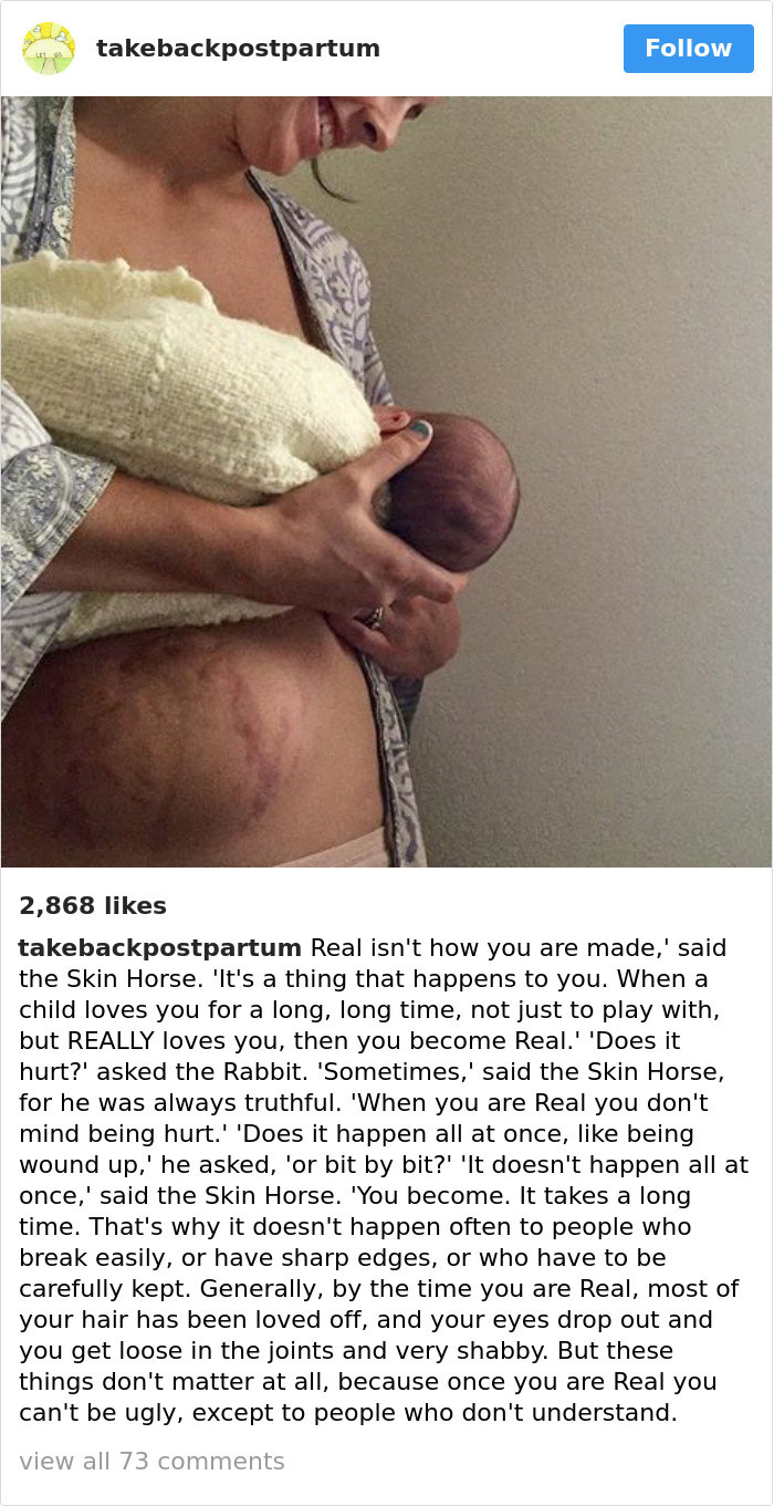 Postpartum Bodies