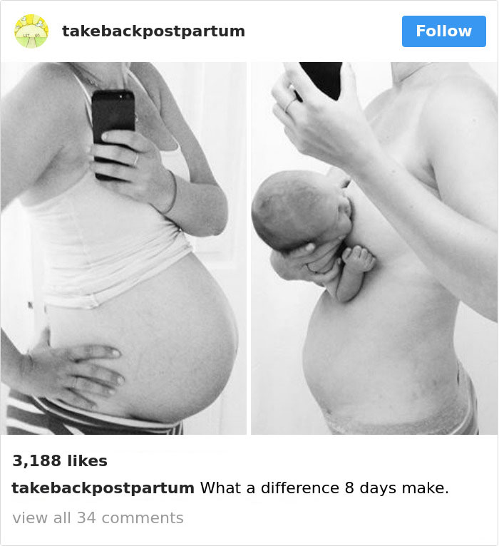 Postpartum Bodies