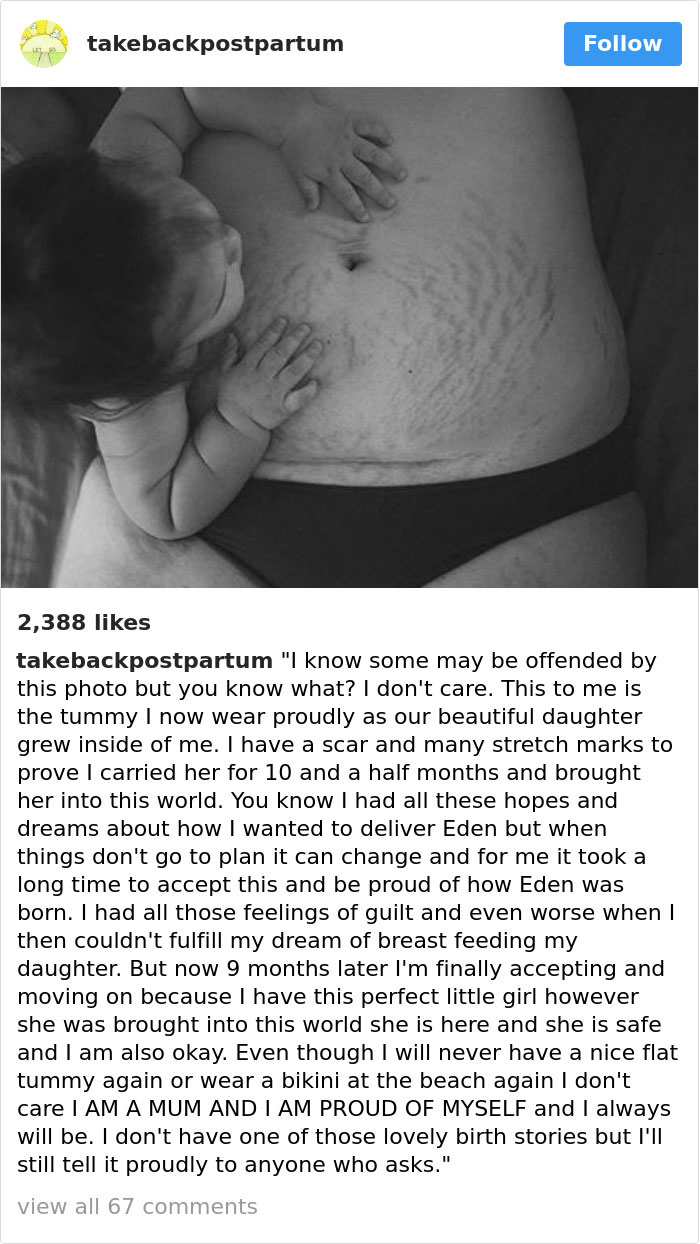 Postpartum Bodies
