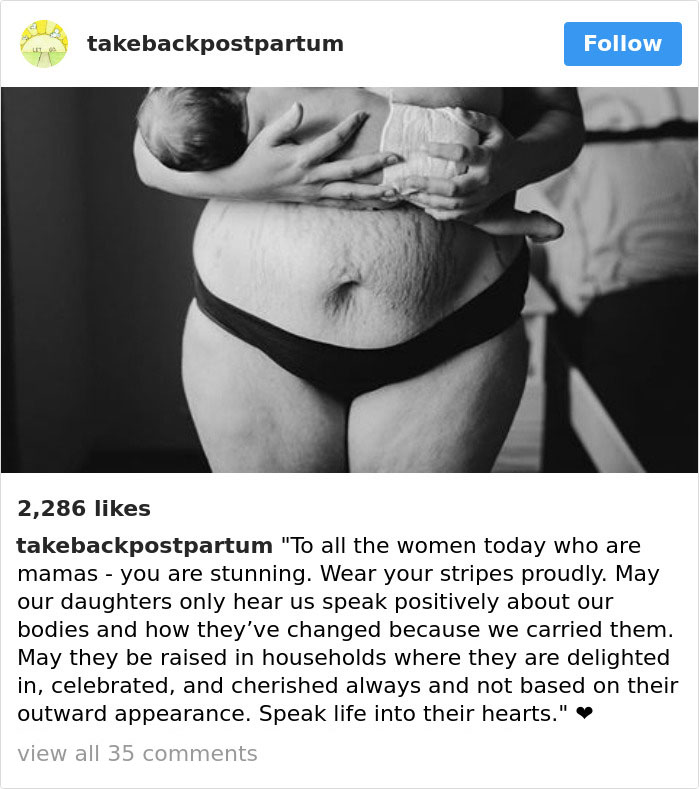 Postpartum Bodies