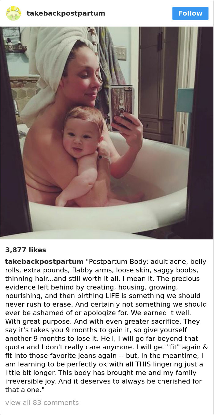 Postpartum Bodies